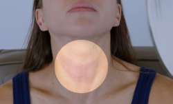4 reasons women should be aware of thyroid disorders
